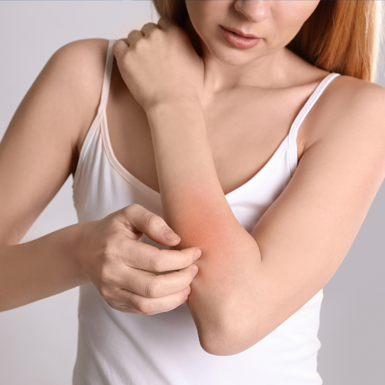 Dermatite atopica, AbbVie lancia Campagna “Rimettiti in Gioco”