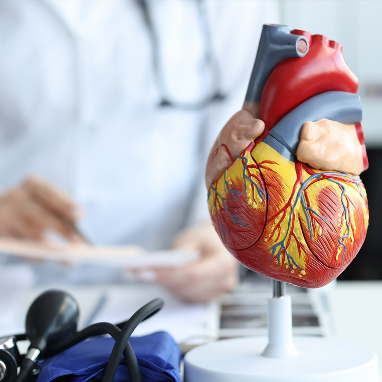 Ipercolesterolemia e malattie cardiovascolari: un legame ad alto ...
